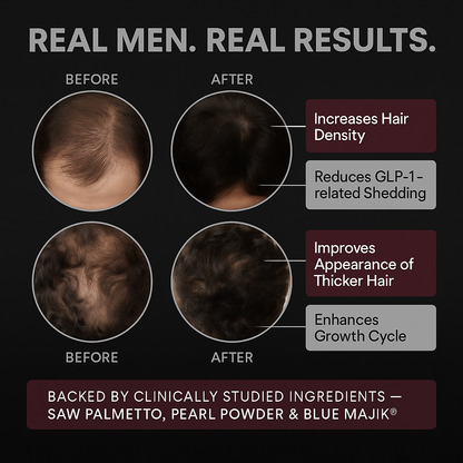 DENSE Regrowth Chews