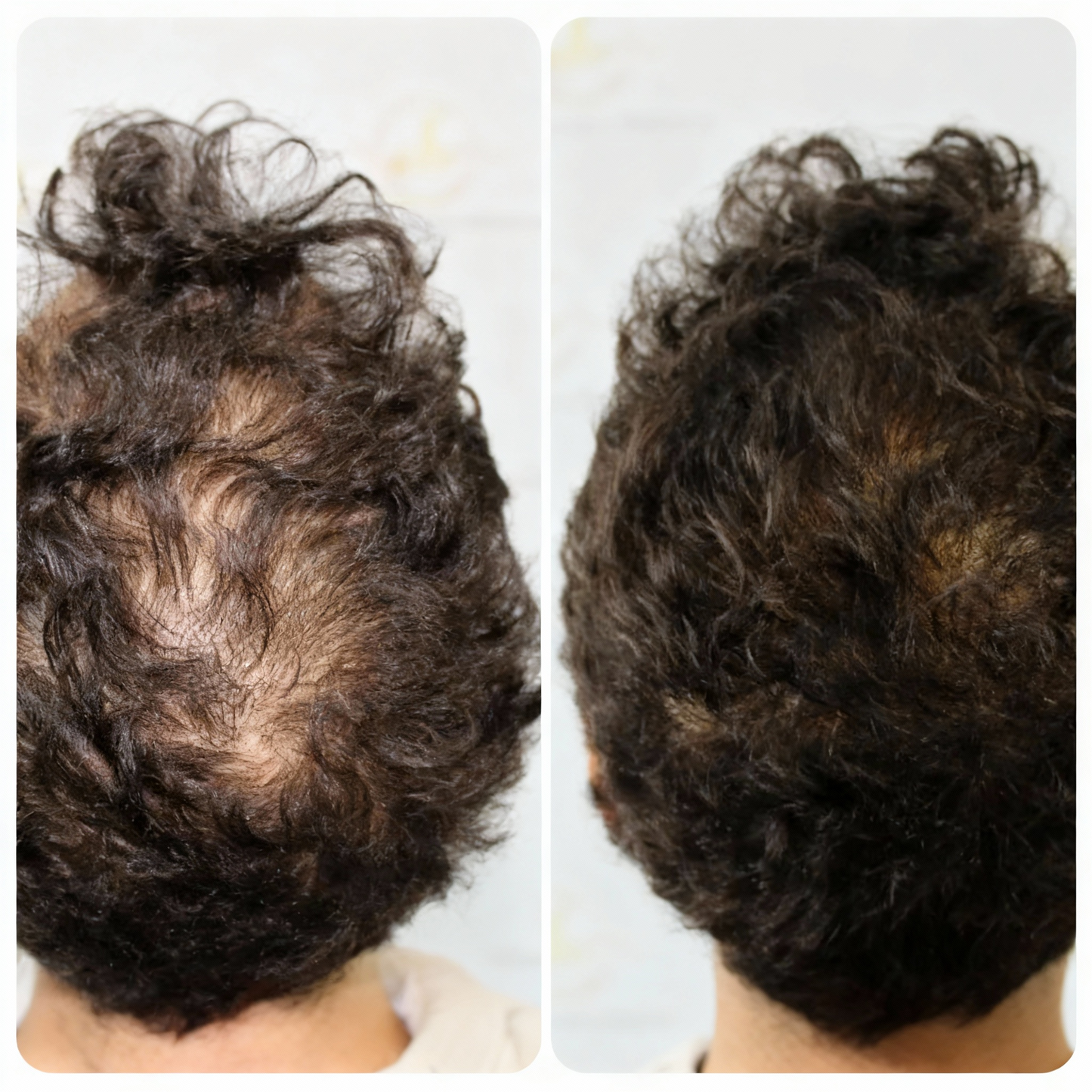 DENSE Regrowth Chews