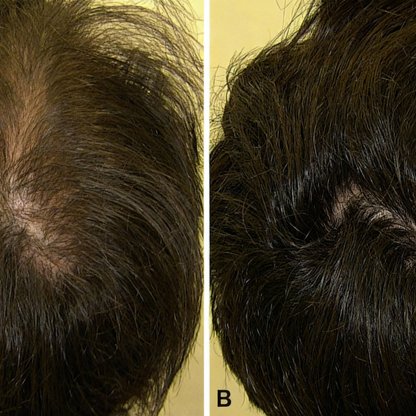 DENSE Regrowth Chews